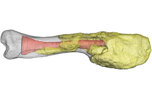 Dinosaur bone with cancer